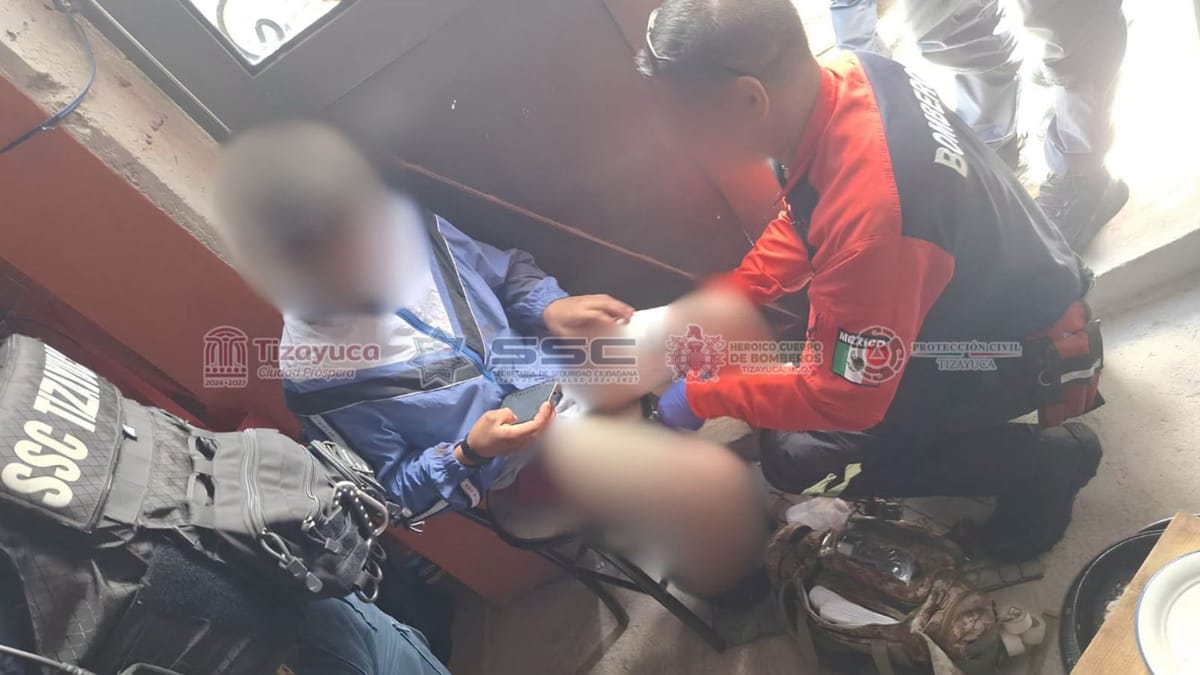 Menor de 12 años resulta herido por disparo de arma de fuego en Tizayuca Post feature image