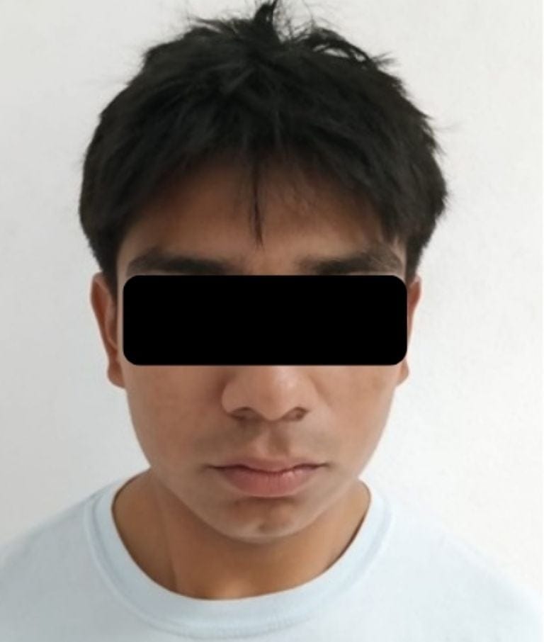 Detienen a presunto narcomenudista tras persecución en Tlahuelilpan Post feature image